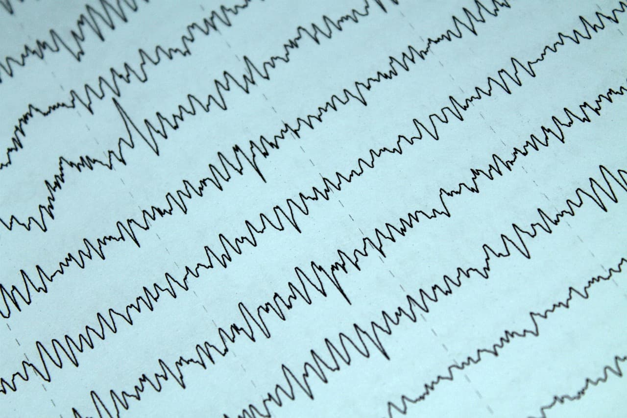 Meta NeuralBench 2026: The Hidden Benchmark That Reshapes NeuroAI